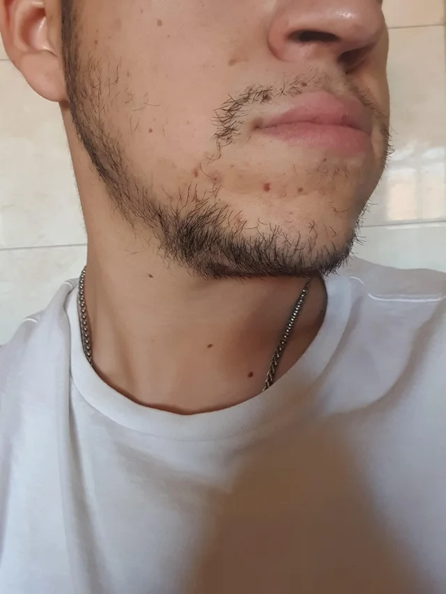 Barba rala