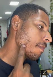 Barba falhada exemplo